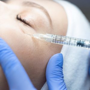 Close,Up,Of,A,Woman,Being,Injected,A,Dermal,Filler