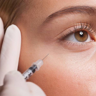 under-eye-gel-injection
