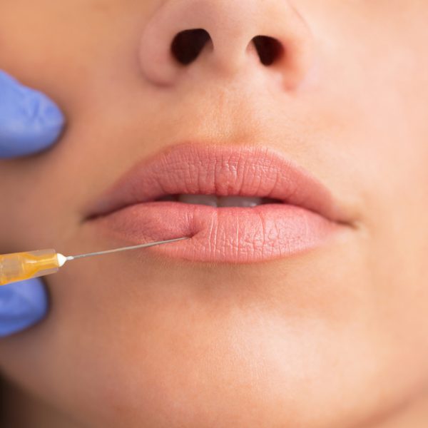 Doctor injecting botox into woman's lips