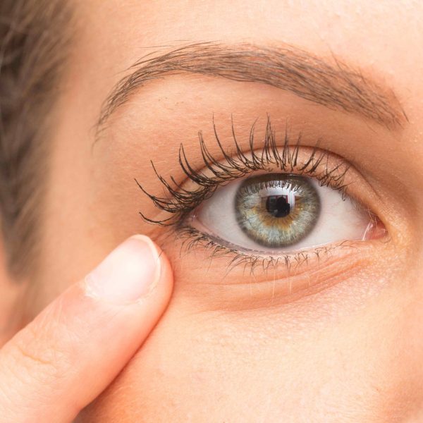 Side-effects-of-fillers-under-the-eyes